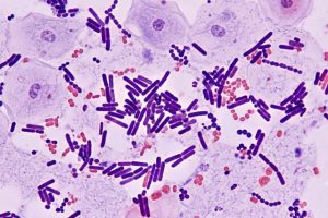 microbiome vaginal