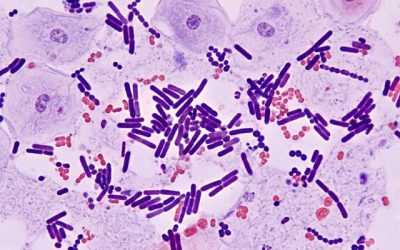 microbiome vaginal