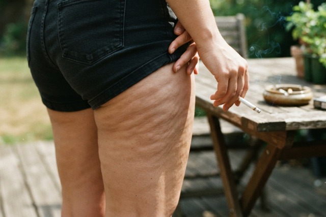 Cellulite et tabac